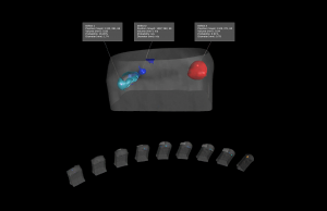 Automated X-ray defect detection in a copper hairpin weld using XVOIDPRO.