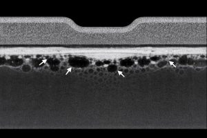 X-ray inspection reveals hidden voids and misalignments in hybrid assemblies.