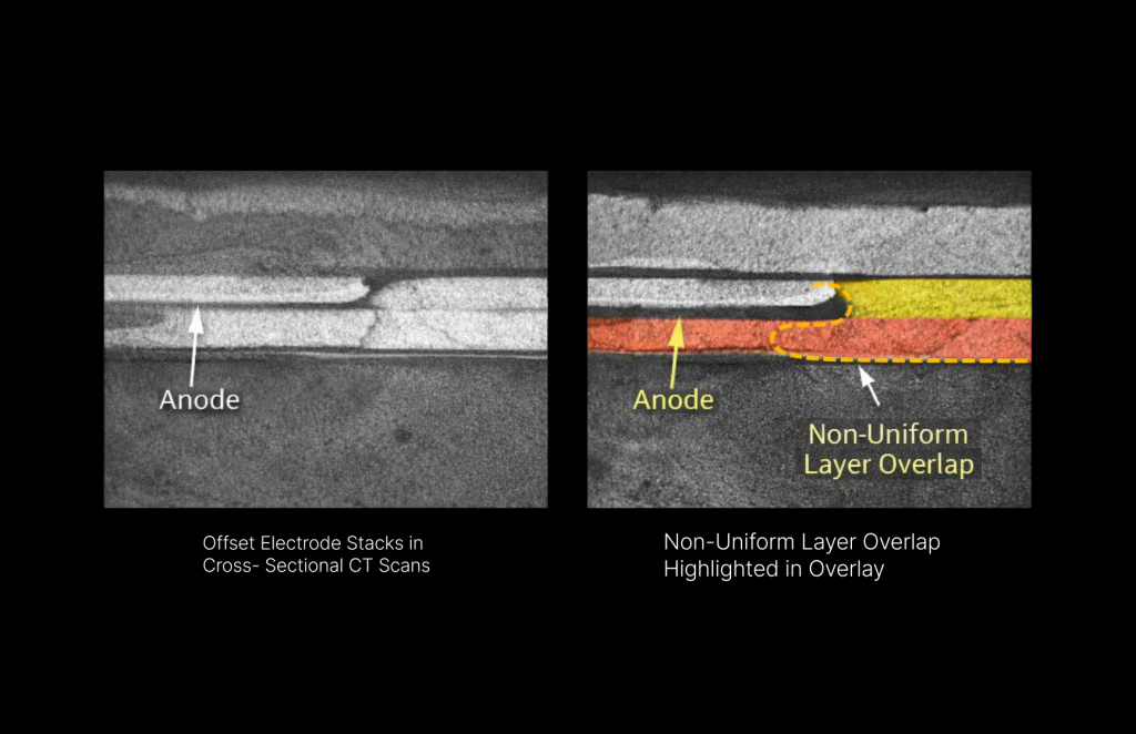 CT cross-sections showing offset electrode stacks