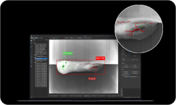 Quantitative Defect & Analysis