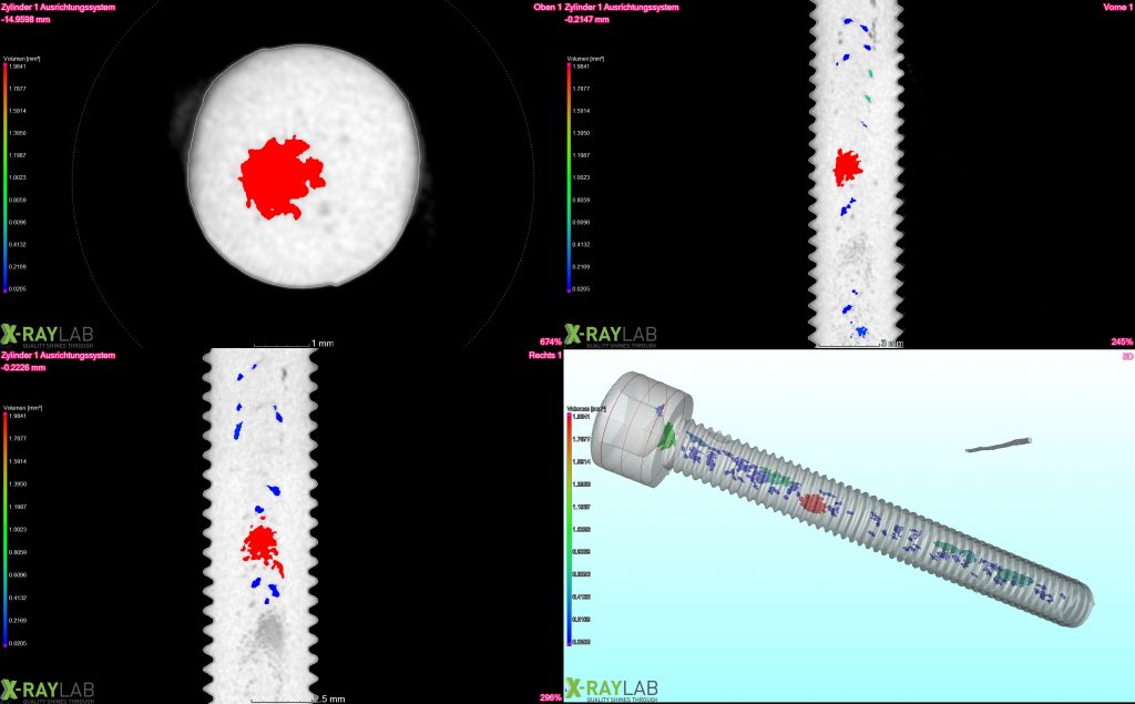 Volumetric 3D CT scan