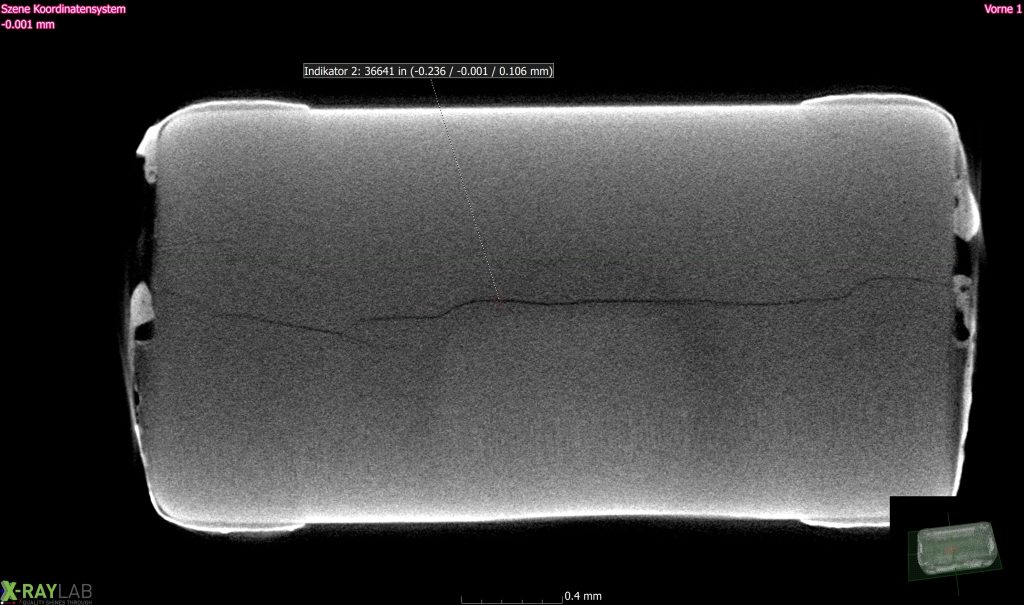 X-ray CT slice